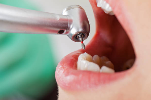 Emergency Dentist for Kids in NJ
